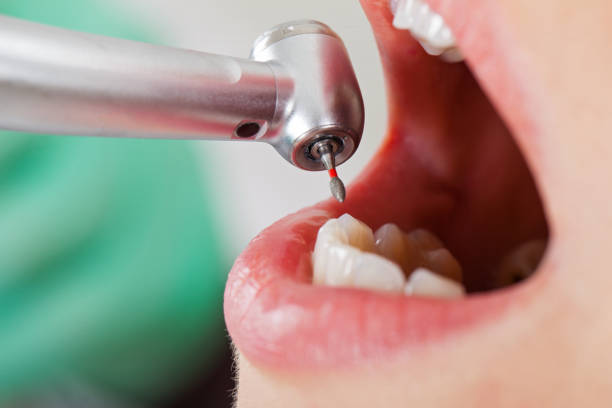 Best Emergency Dental Care for Sports Injuries in Elkader, IA